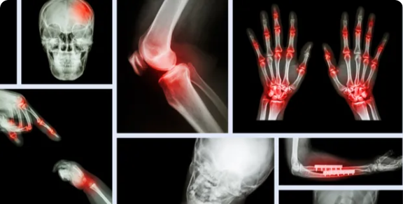 医療オブジェクトの分類