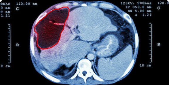 医療オブジェクトの検出