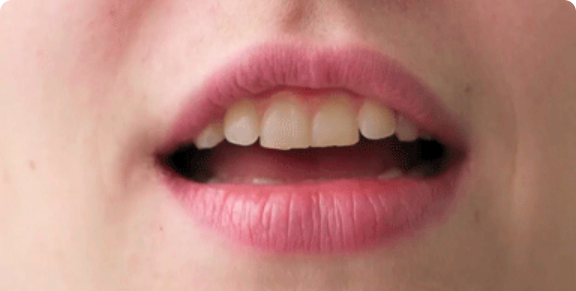 リップリーディング